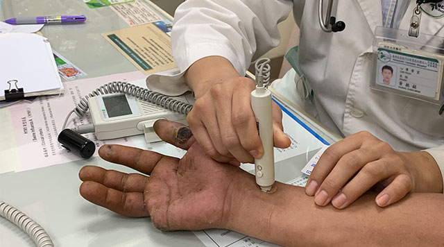 門諾心臟外科醫師黃振銘柏格氏症戒菸就能及早治療