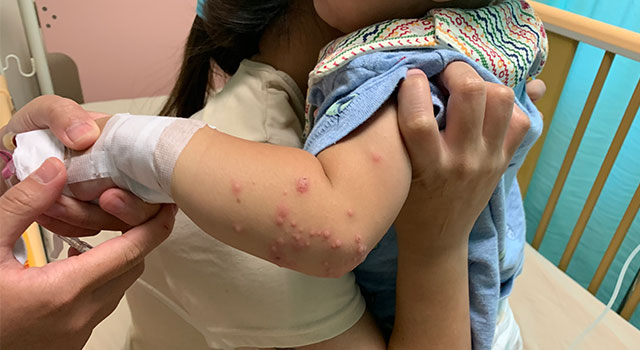 門諾醫院預防腸病毒宣導