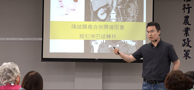 小心大腸息肉變成癌 定期檢查有助保「腸」健康